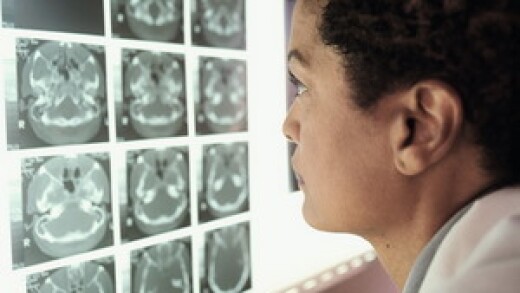 A doctor staring at x-rays.