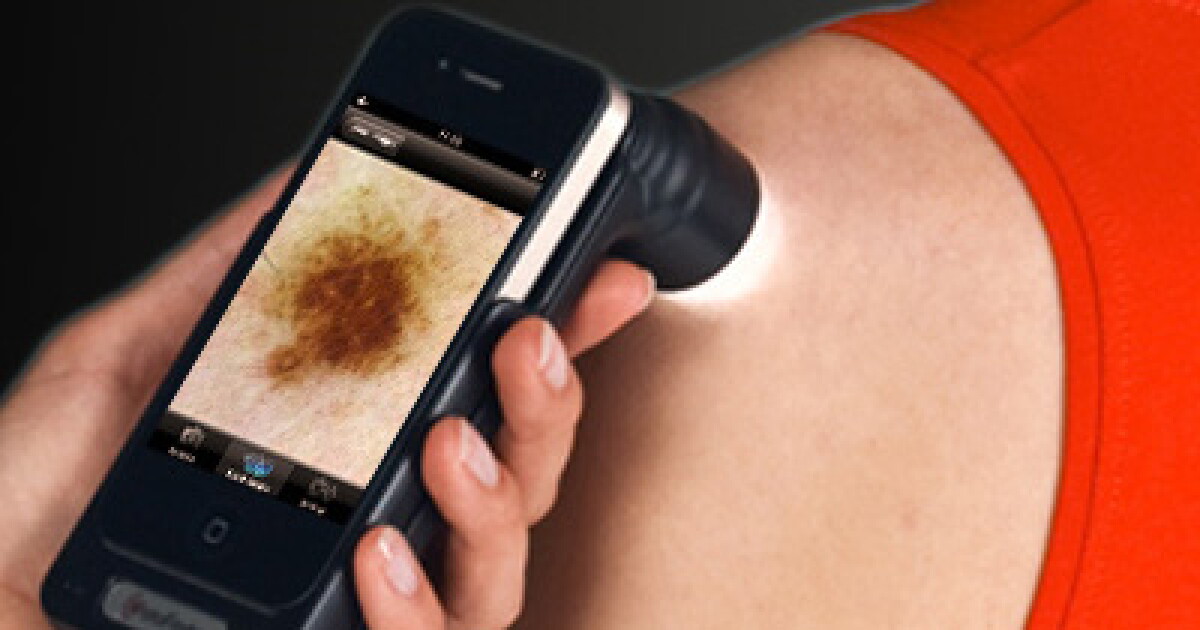 Hand Rashes Scanning Using Phone Images Deep learning technique works on smartphone to find skin lesions ...