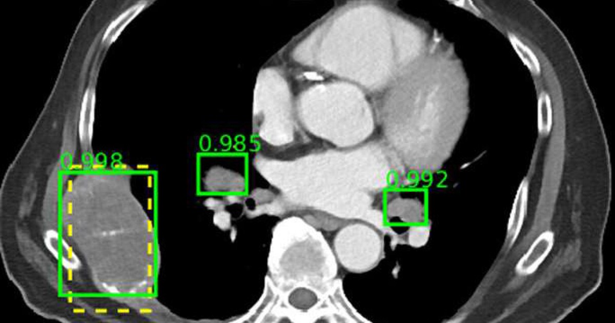 NIH Clinical Center releases CT image dataset to researchers Health