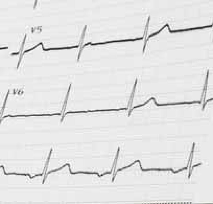 constantlinegraph.jpg
