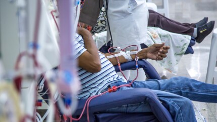 People sitting in chairs getting treatment at a medical facility.